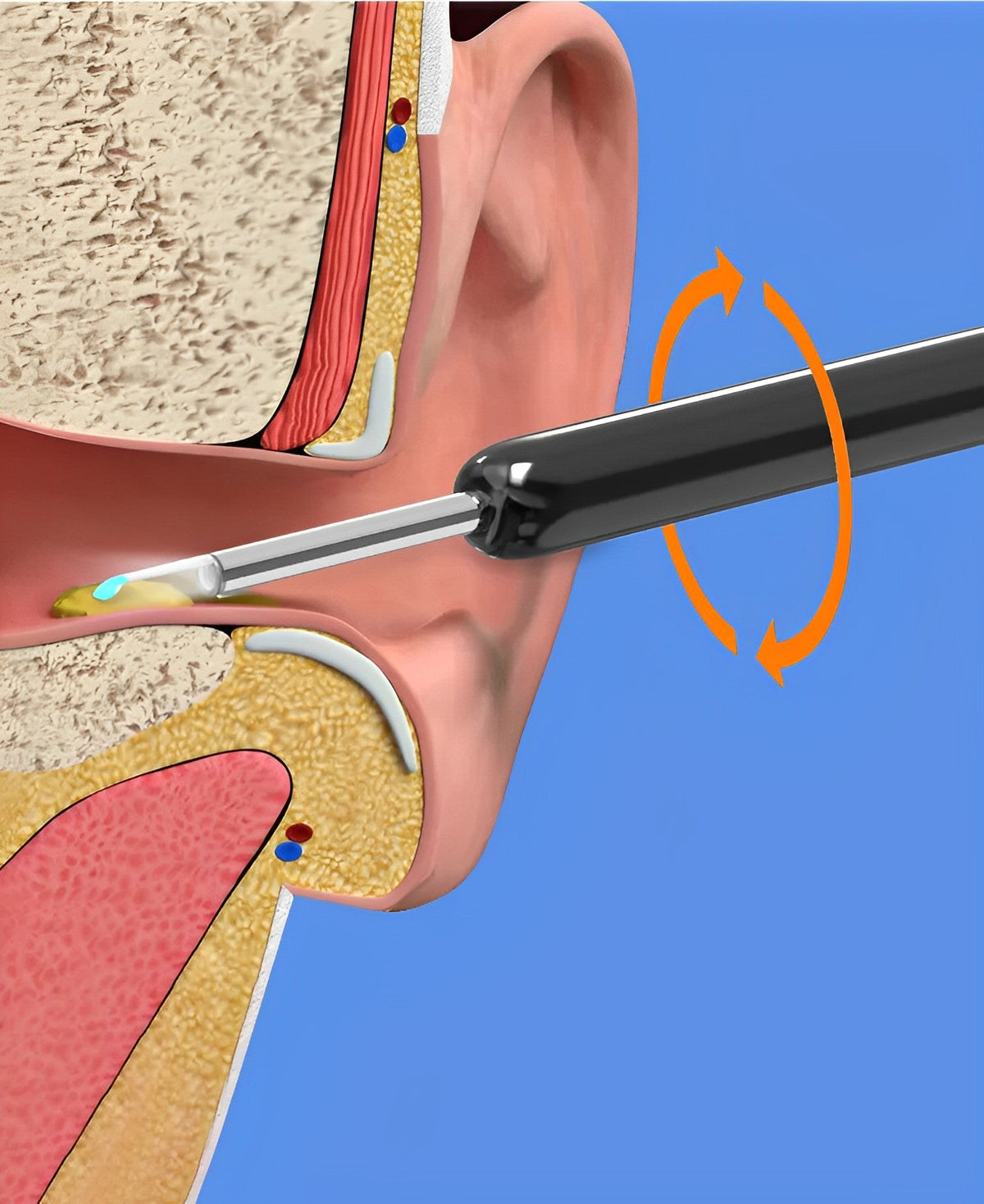 EarBit 3000 - Outil de nettoyage des oreilles avec caméra